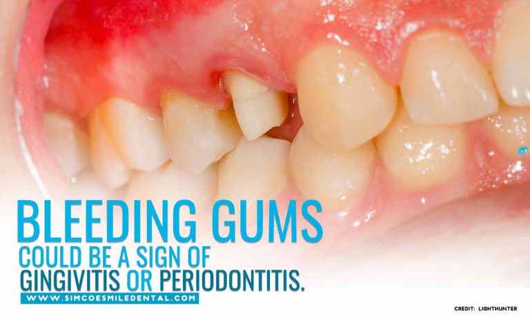 Dental Symptoms You Should Never Ignore