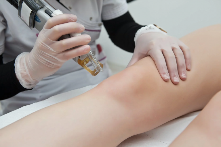 Bikini Hair Removal Laser Treatments