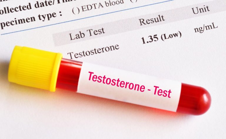 Clomid for Testosterone Replacement